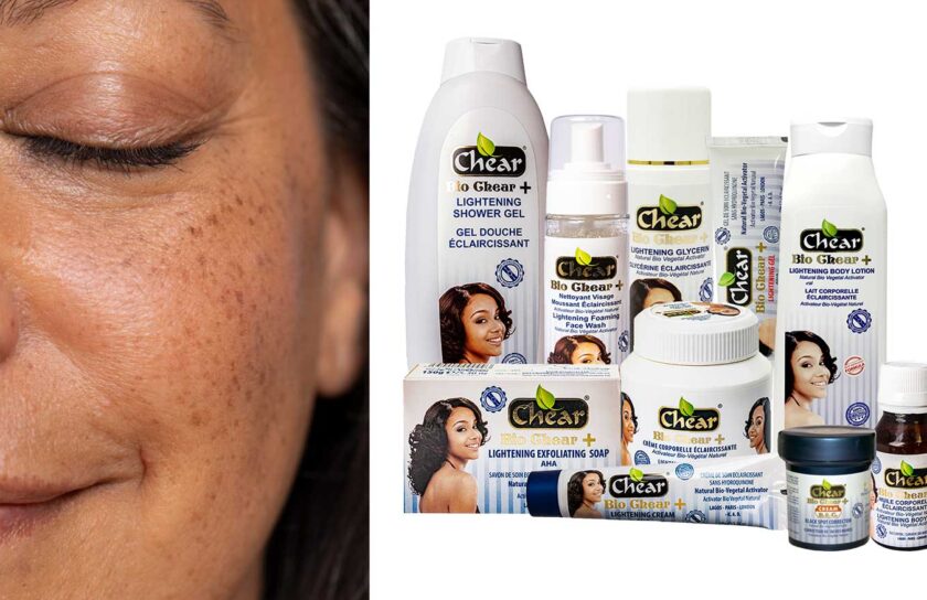Learn how to remove sun tan naturally using the Chear Bio pigmentation range. This research-backed routine features kojic acid
