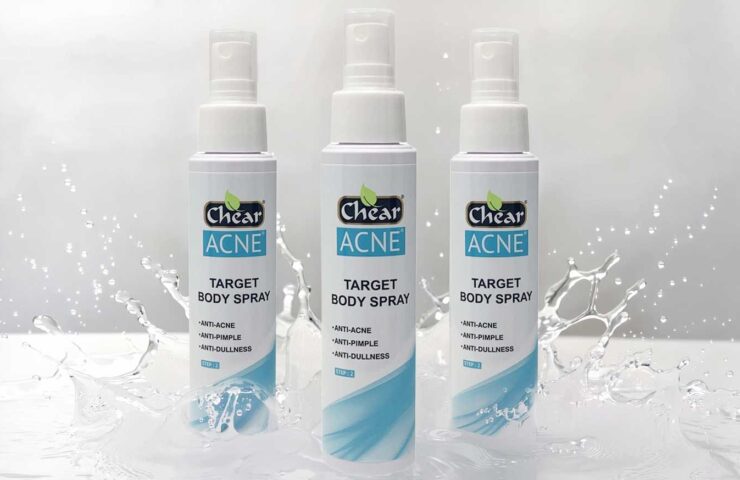 Body Acne Treatment Spray