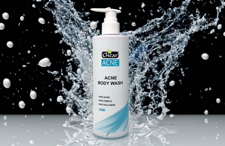 Chear Acne Clearing Body Wash: The Ultimate Solution for Acne Free Skin