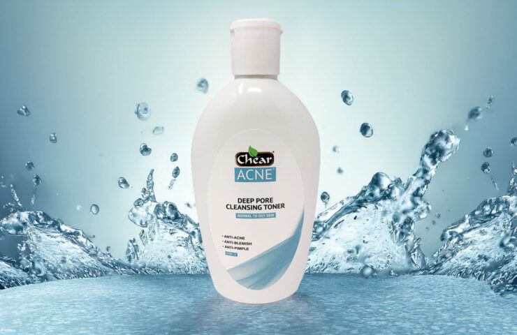 How to Use Chear Acne Deep Pore Cleansing Toner for Maximum Acne-Fighting Results