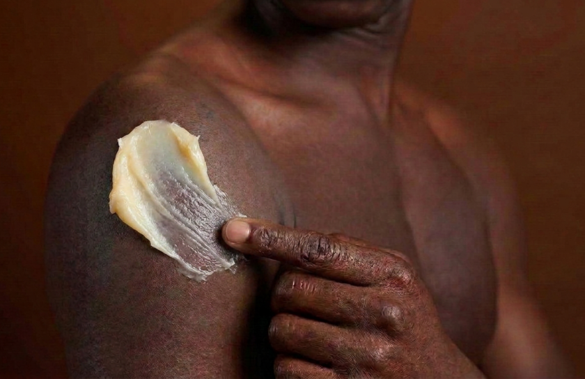 Golden shea butter cream being spread with a fingertip on the shoulder, showing its natural waxy texture