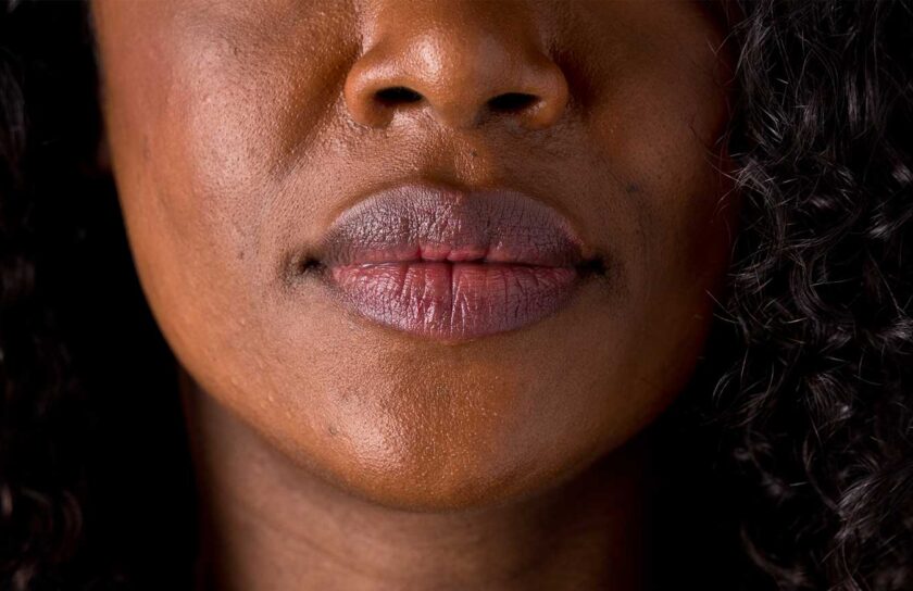 best lip balm for dark lips