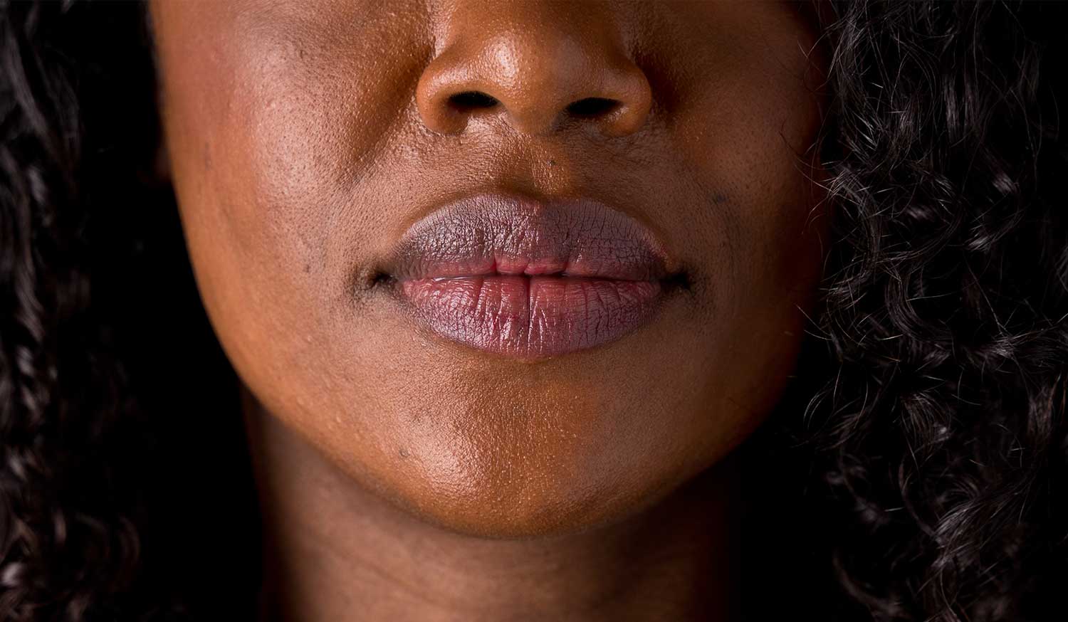 best lip balm for dark lips